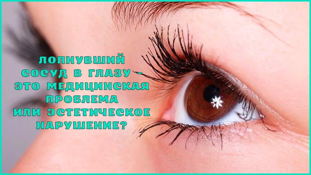 Лопнули капилляры какие капли. Лопнули капилляры какие капли