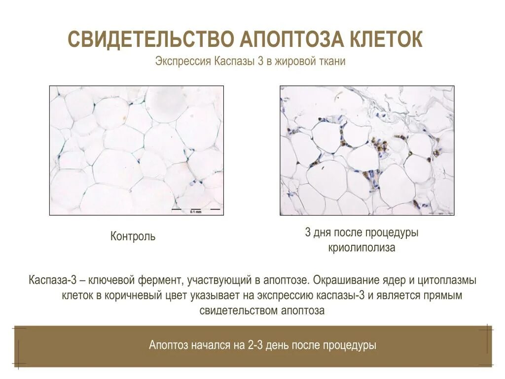 Жировая ткань латынь. Стволовые клетки жировой ткани. МСК жировой ткани. Белая жировая ткань разделена на ячейки. Бурая жировая ткань.