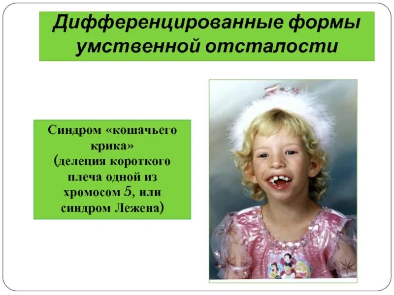 УМСТВЕННАЯ ОТСТАЛОСТЬ.Диагнозу быть?