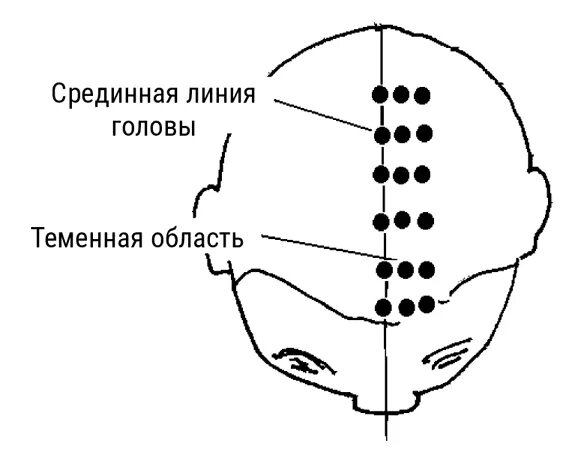 Срединная линия головы. Срединная линия лба. Затылочная зона головы. Шаблон зоны головы.