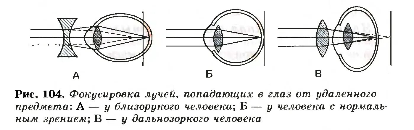 Фокусировка лучей света на внутренней