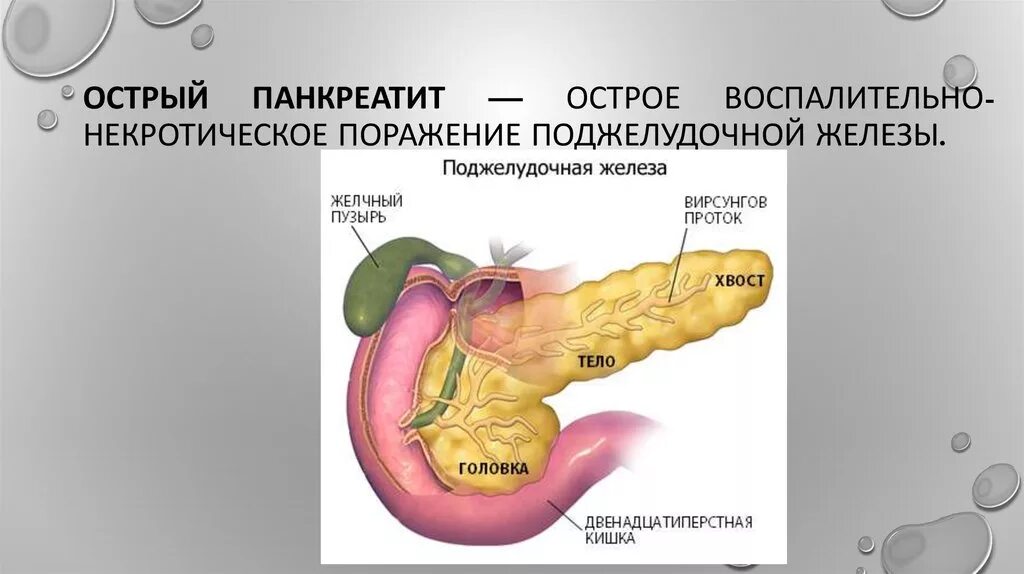 Панкреатит скорая шпаргалка. Острый некротический панкреатит. Упражнения для поджелудочной. Скорая и панкреатит.