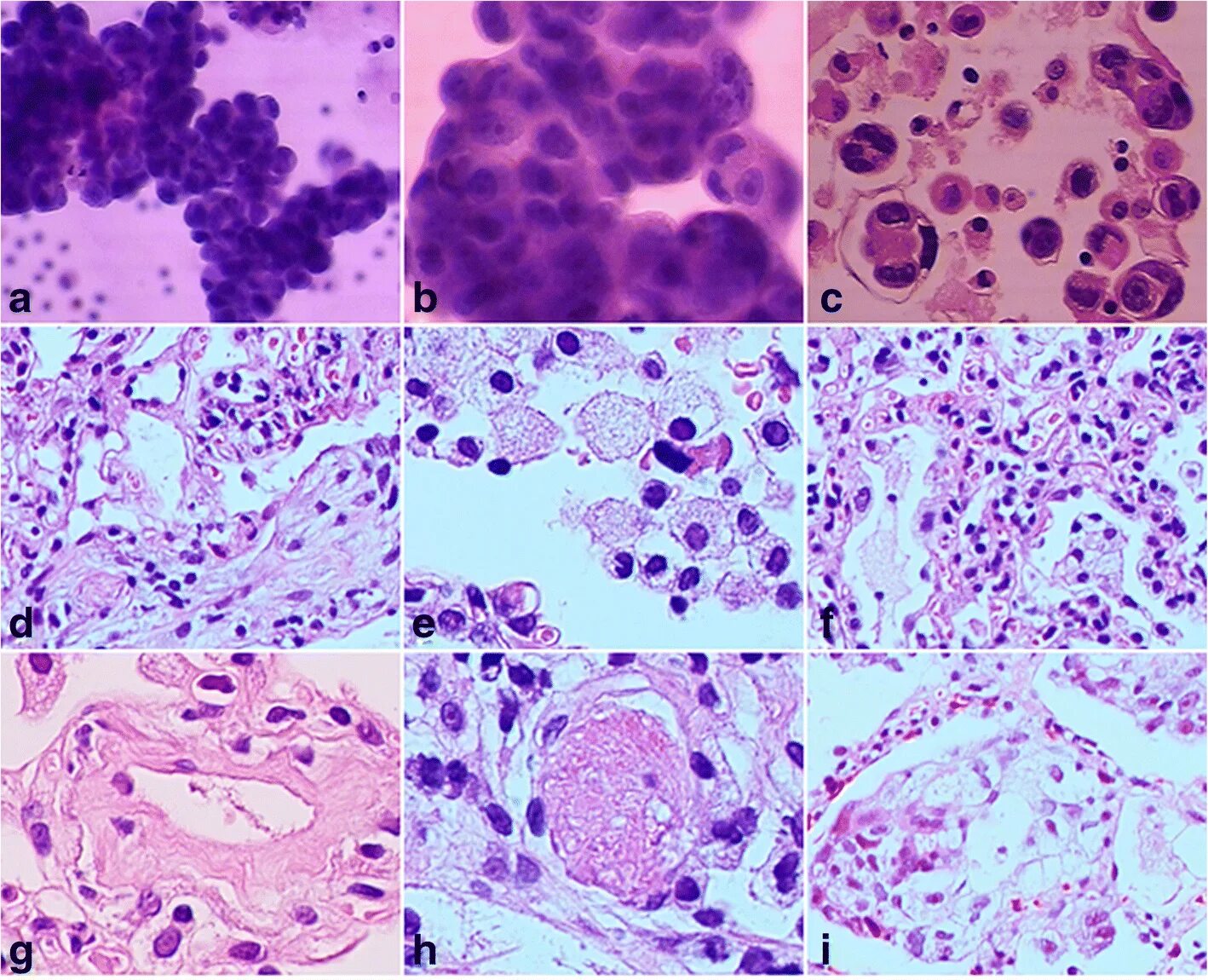 Тучные клетки в микроциркуляции. Cells, Tissues, and disease. "DCFHDA" staining. Diseases associated