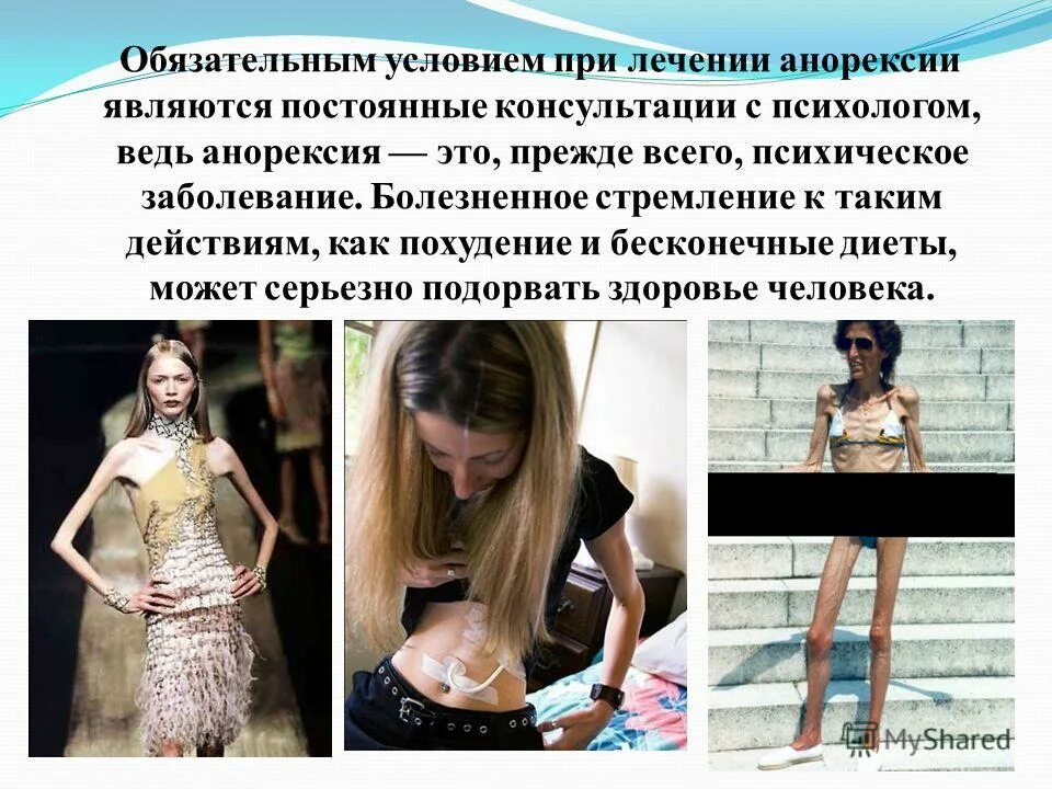 психотерапия пищевого поведения. расстройства пищевого влечения. клинические проявления анорексии. анорексия причины и профилактика. расстройство пищевого поведения психиатрия шурова.