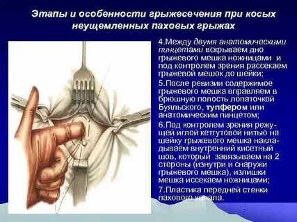 Возникновение грыжи