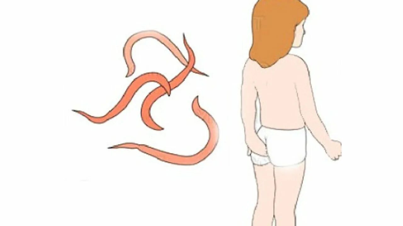 Глисты симптомы как определить. Глисты симптомы как определить