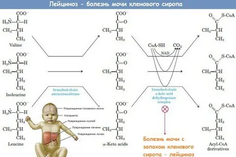 Болезнь кленового сиропа тесты нмо с ответами