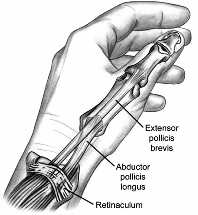 лучевой стилоидит лучезапястного сустава. Swr 602 бандаж на лучезапястный сустав. лучевой стилоидит лучезапястного сустава. лучевой стилоидит запястья. ортез при теносиновит де кервена.