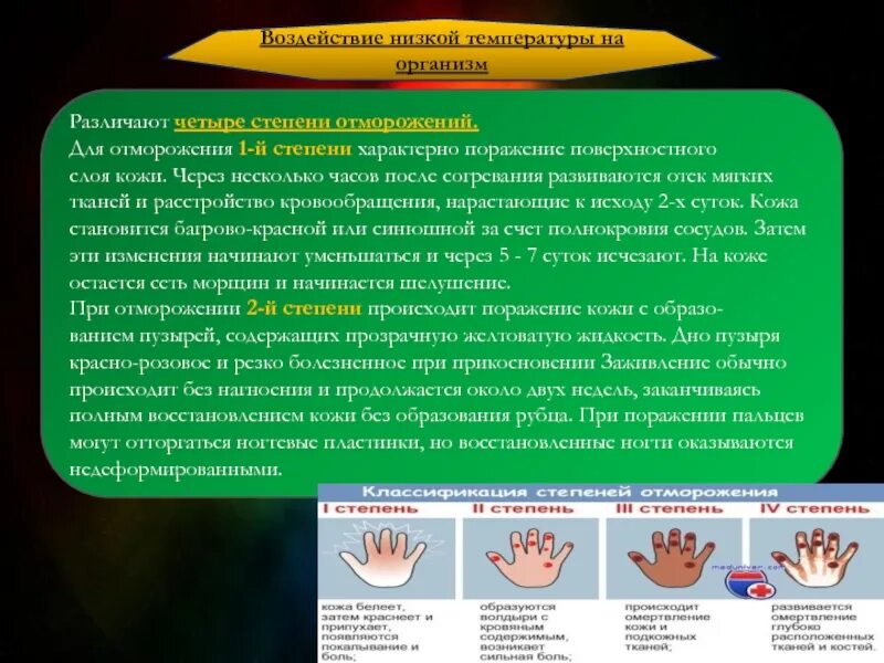 При отморожении II степени пузыри наполнены:. Вторая стадия 4 степени отморожения. Воздействие низких температур. Воздействие низких температур стадии. Организация ситуации влияния