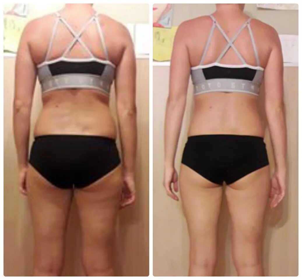 Интуитивное питание. Роскошные девушки после похудения. На интуитивном питании можно похудеть. Интуитивное питание до и после. На интуитивном питании можно похудеть.