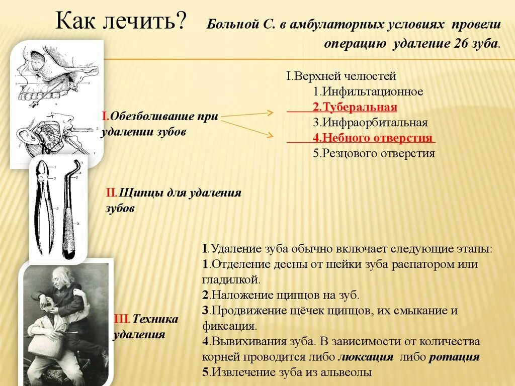 Этапы операции удаления зуба. Ротация и люксация в стоматологии.