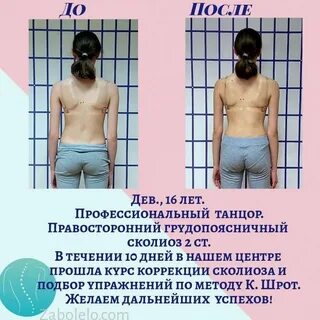 Шрот при сколиозе