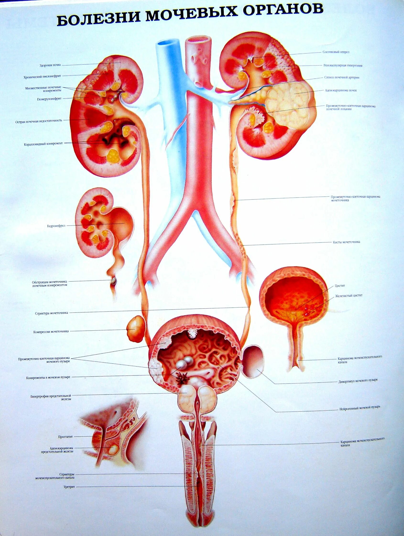 Основной орган мочевыделительной системы человека. Мочеполовые органы человека. Мочеполовая система почки анатомия. Мочевыделительная система анатомия заболевания. Мочевыделительная система анатомия человека у мужчин.