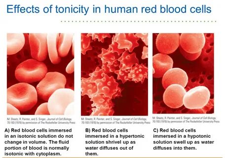 Red human