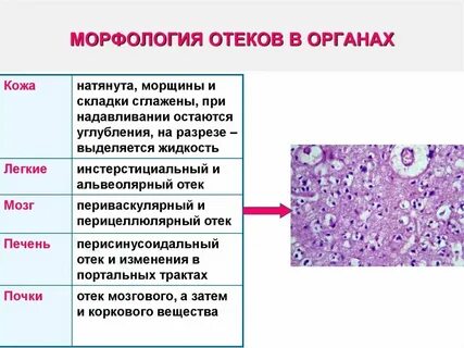 Отек белок