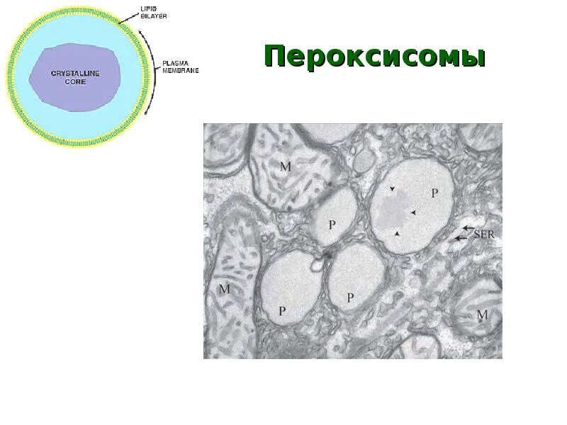 Ферменты лизосом синтезируются в. Лизосомы и пероксисомы. Пероксисома строение. Пероксисомы строение. Лизосомы и пероксисомы строение и функции.