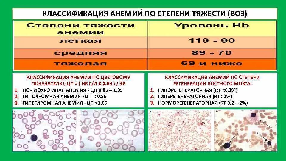 Моча при анемии. Классификация анемий по степени тяжести воз. в12 дефицитная анемия классификация по степени тяжести. классификация тяжести анемии по гемоглобину. классификация анемия по тяжести степени по воз.