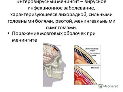 Серозный менингит симптомы у взрослых