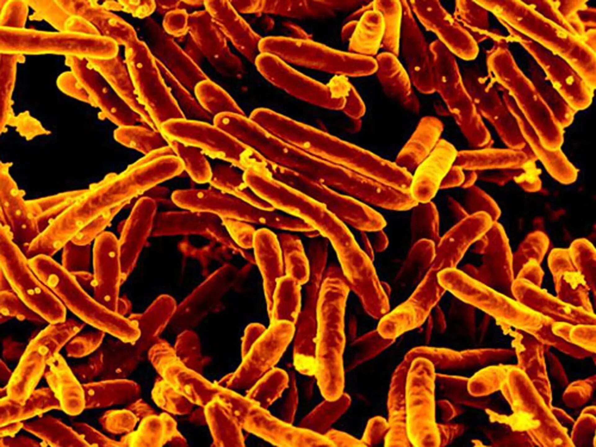 Бактерия Mycobacterium tuberculosis. Микобактерии туберкулеза электронная микроскопия.