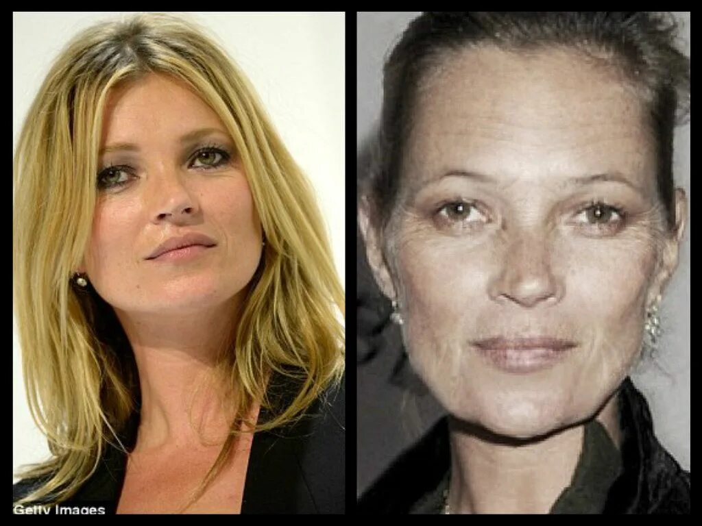 Курящие до и после. Лицо курильщика женщины. Лицоп после курения. Лицо курильщика до и после.