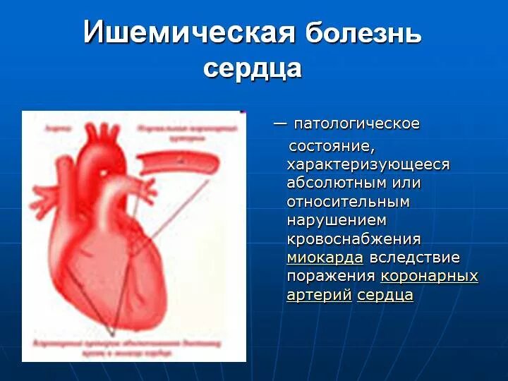 Сколько живут с ишемией. Ишемическая болезнь сердца (ИБС).