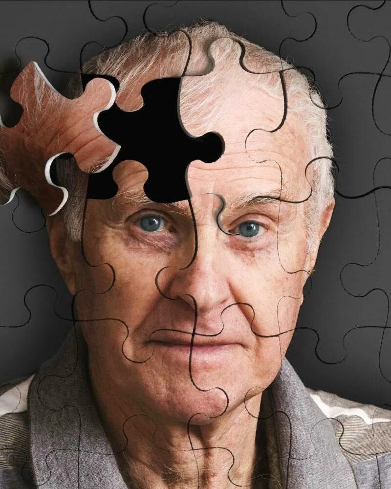 Болезнь Альцгеймера деменция. Энн Вудс болезнь Альцгеймера. Старческое слабоумие.