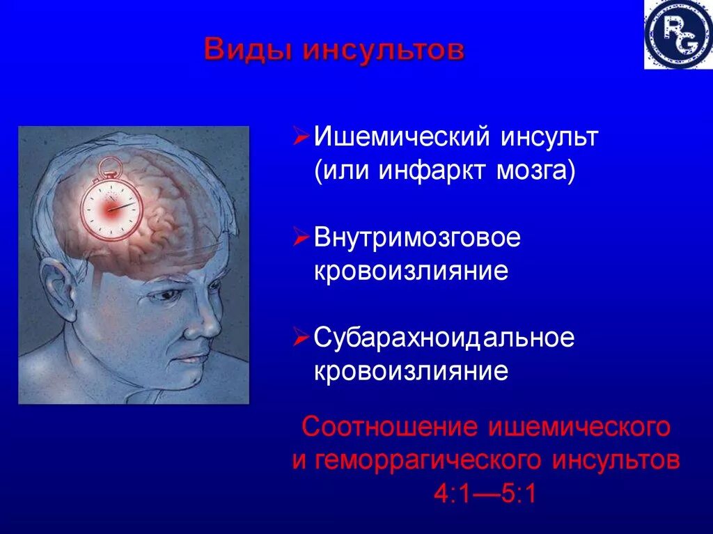 Инфаркт мозга причины. Формы инсульта. Формы ишемического инсульта. Разновидности ишемического инсульта.