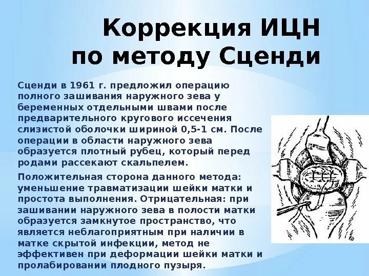 Наложение швов при истмико-цервикальной недостаточности. Наложение швов при ИЦН при беременности. Методы коррекции истмико-цервикальной недостаточности. Швы при истмико цервикальной недостаточности. Швы при ицн