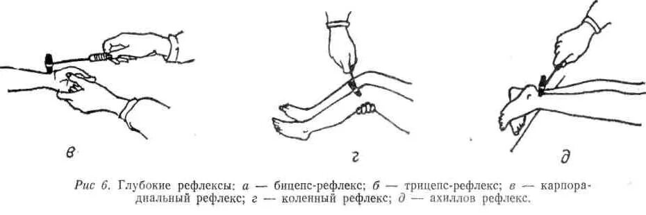 Рефлекс с двуглавой мышцы плеча схема. Поястнолучевой рефлекс. Рефлекс с сухожилия двуглавой мышцы плеча. Рефлекс с сухожилия двуглавой мышцы плеча рефлекторная дуга. Проверка рефлексов