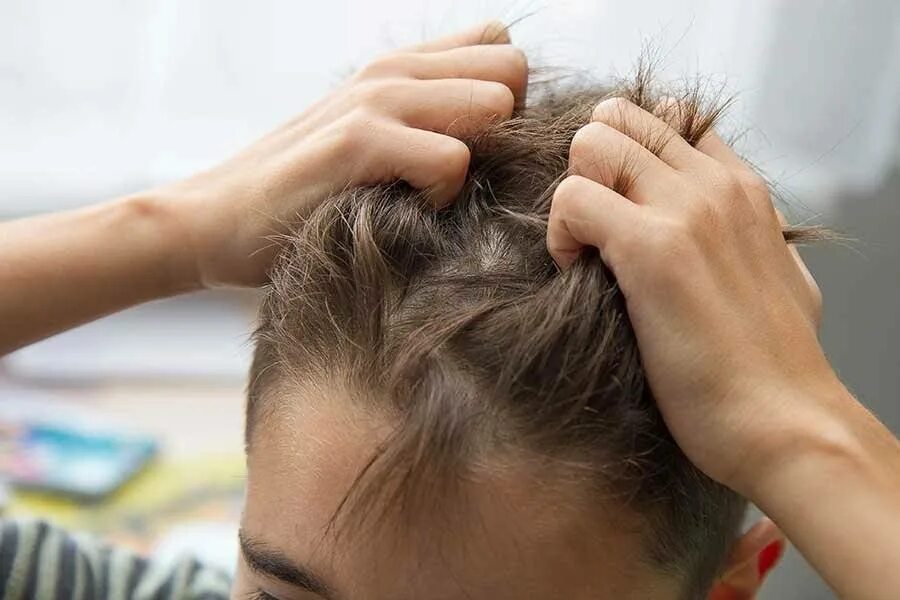 Зуд при вшах. Зуд при вшах. Зуд при вшах. Волосистая часть головы. Волосистая часть головы.