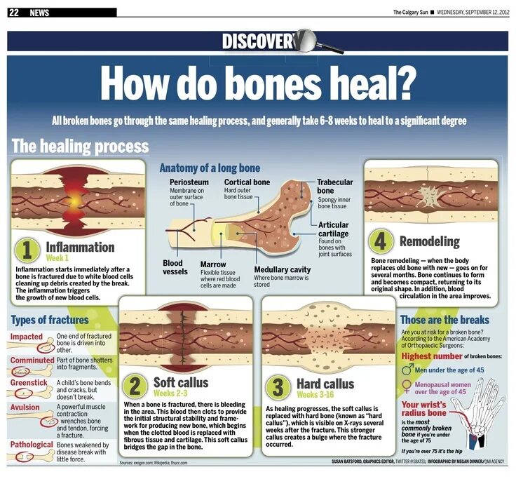 Bones how. Bones how