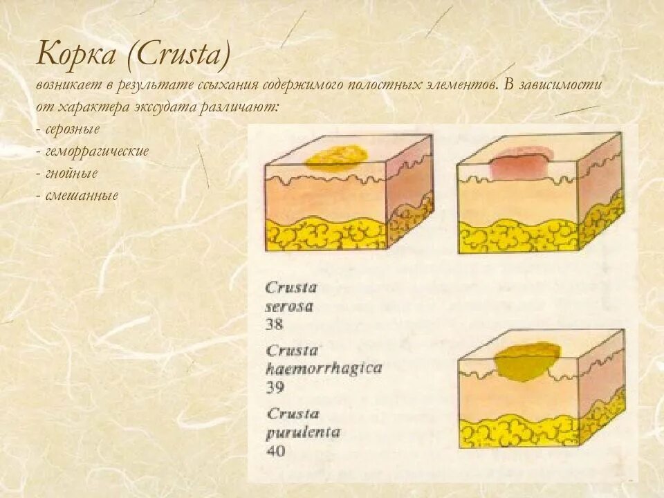 Корка корка кг. Перидерма и корка. Третичная покровная ткань растений. Третичная покровная ткань корка. Первичные и вторичные морфологические элементы кожной сыпи.
