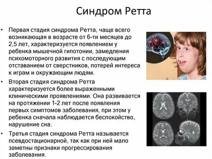 Почему у детей взрослые лица