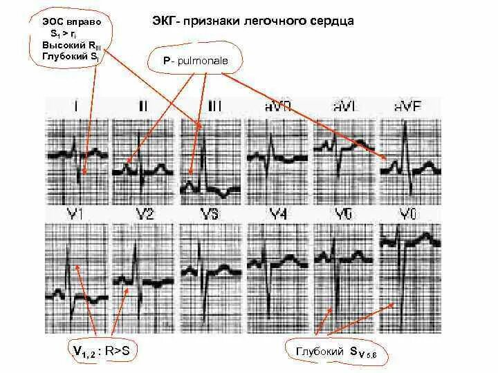 S тип эос