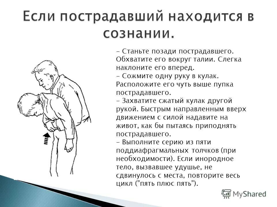 Маневр геймлиха. Прием геймлиха при инородном теле. Инородное дело в дыхательных путях рисунок. Прием геймлиха. Инородные тела верхних дыхательных путей у детей.