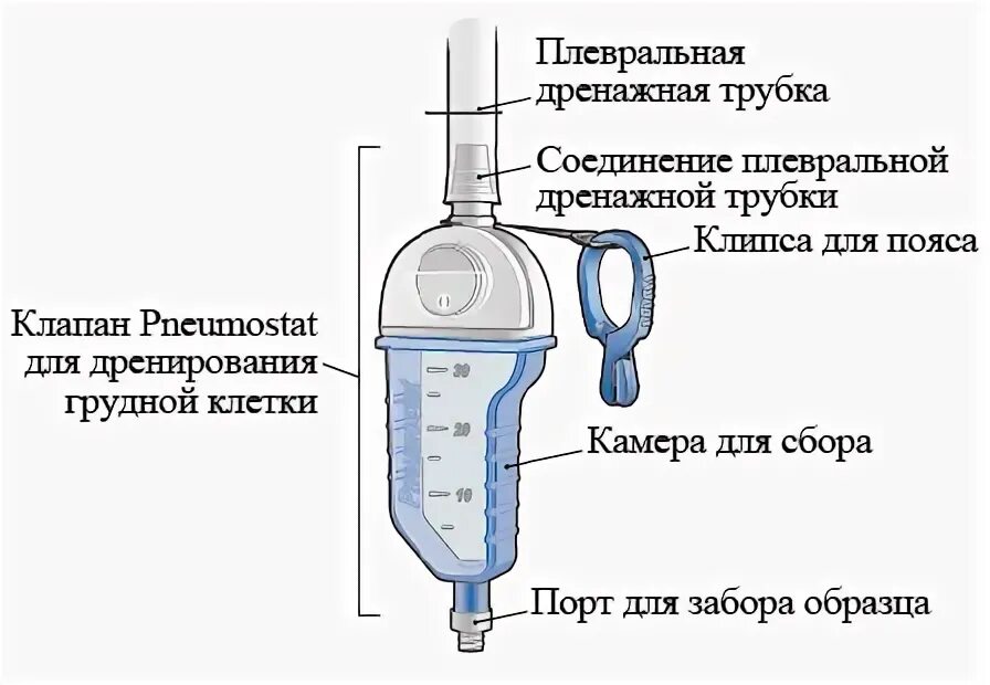 Небольшая температура. Дренажные трубки хирургические. Температура после дренажа. Гнойно инфильтративный мастит. Дренаж после операции желчного пузыря.