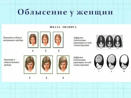 Психосоматики волосы