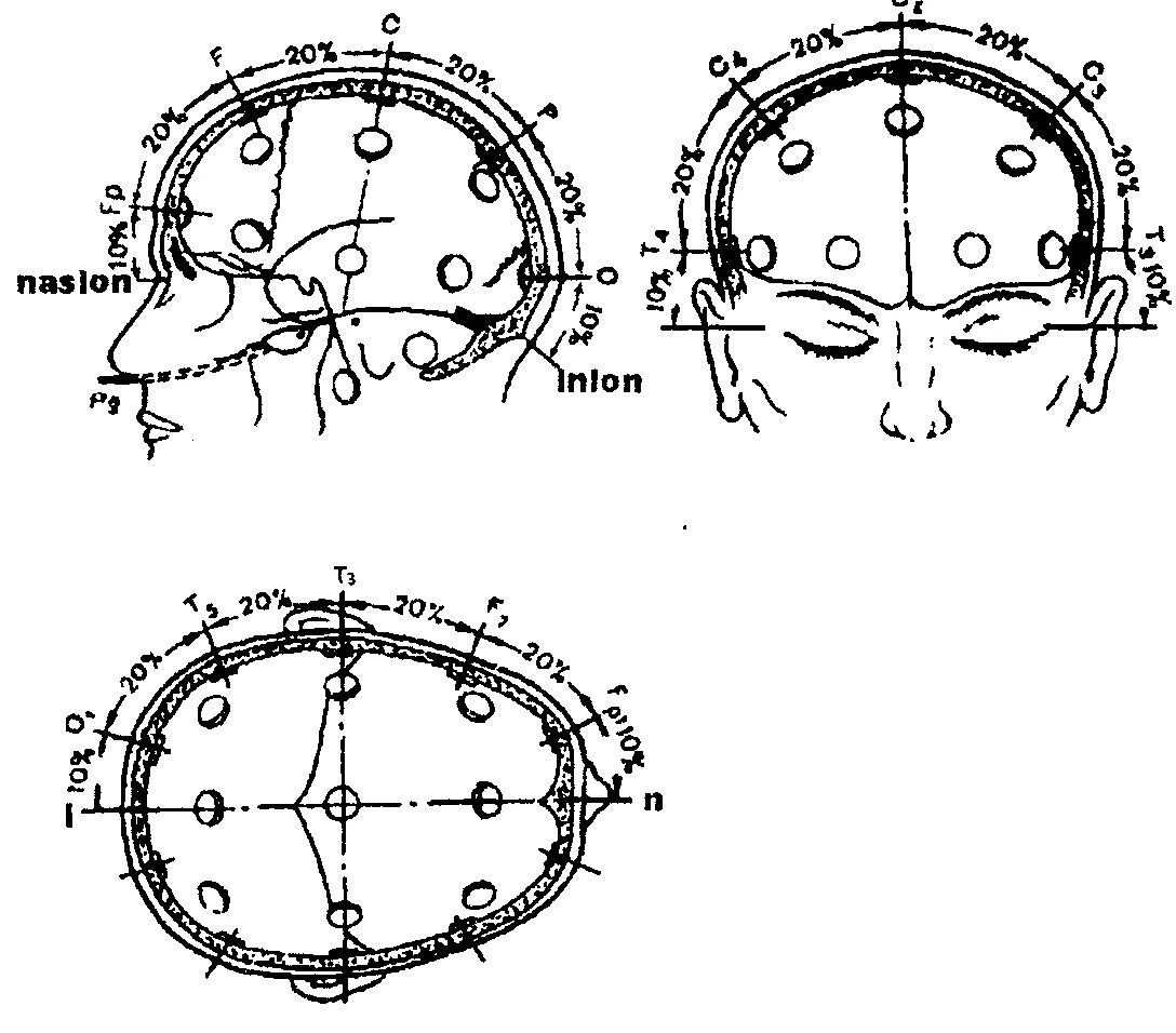 Ээг 10 10. Схема расположения электродов при ЭЭГ 10-20. 10-10 Схема ЭЭГ. ЭЭГ наложение электродов схема 10-20. Международная схема электродов ЭЭГ 10-20.