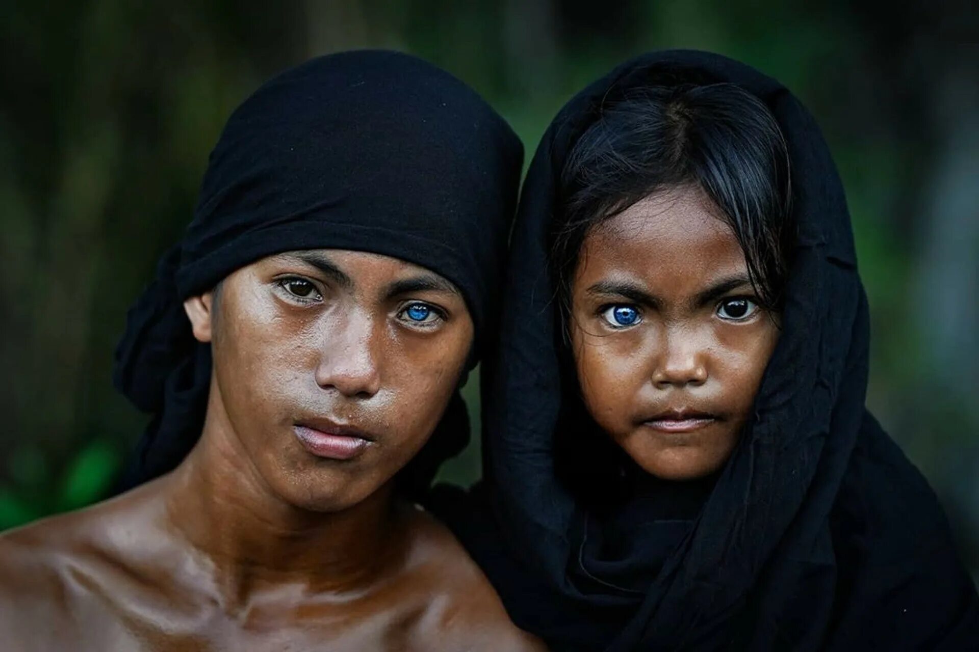 The World's Biggest Albino Family Albino, Albinism, Albino people beautiful