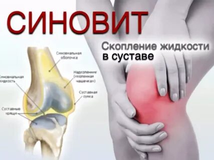 Выпот коленного сустава что это