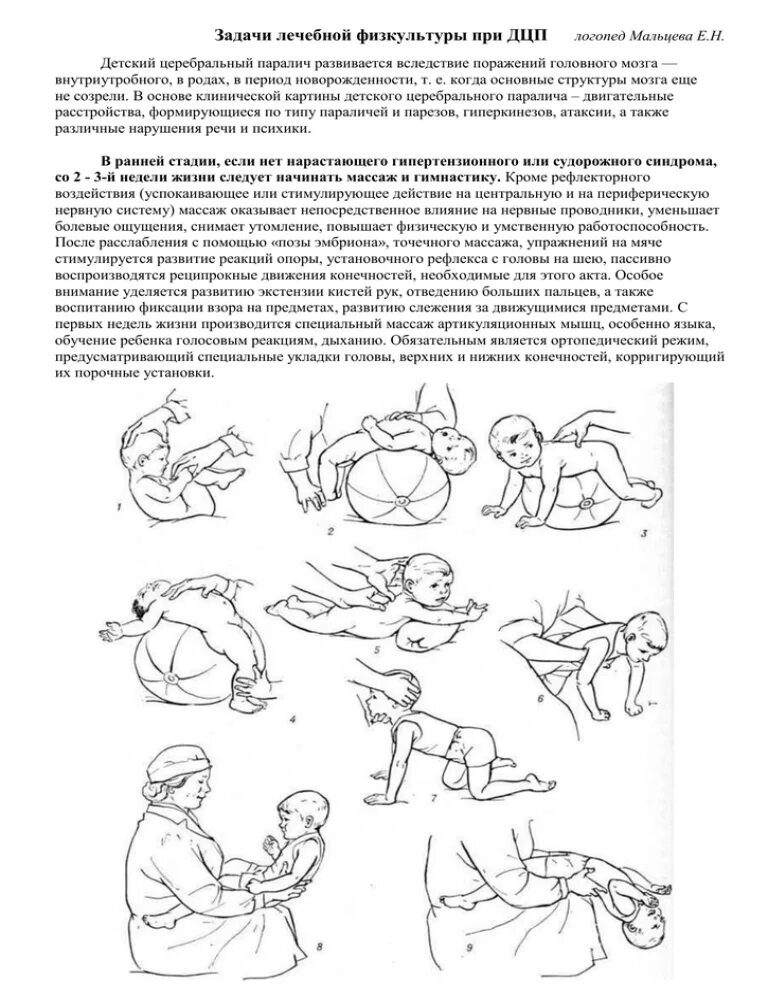 Упражнения при энцефалопатии