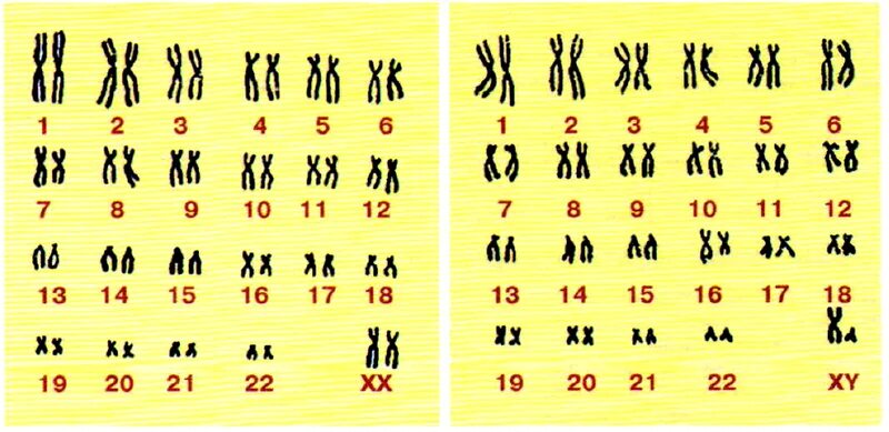Кариотип человека составляет. Кариотип человека составляет. Хромосомный набор клетки кариотип. Кариотип человека составляет. Клетка печени кариотип.