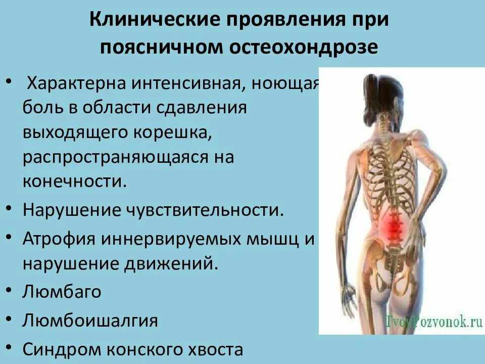 Клинические проявления остеохондроза. Проявления поясничного остеохондроза. Основные симптомы остеохондроза. Синдромы при поясничном остеохондрозе.