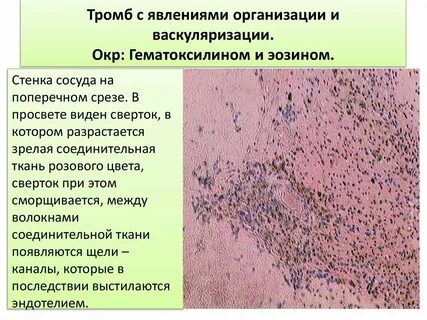 Васкуляризация что это
