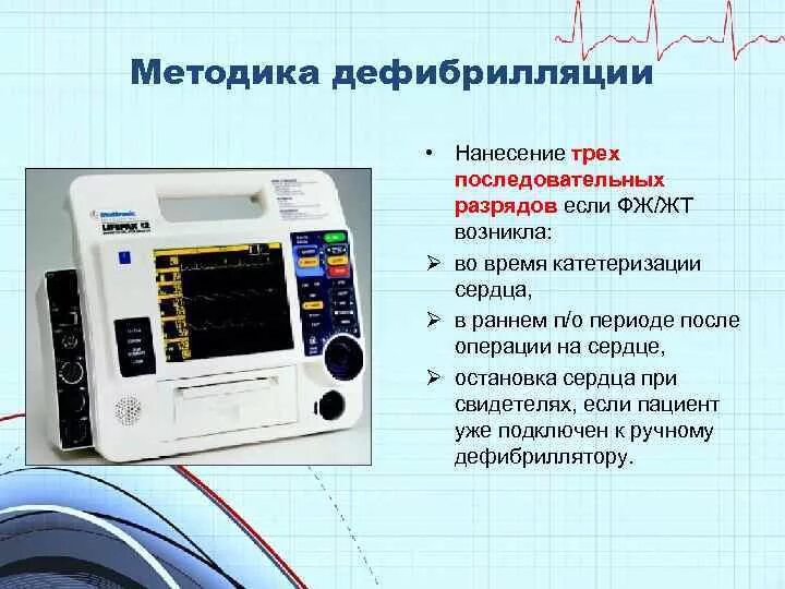 Проведение дефибрилляции сердца. Дефибрилляция методика проведения. техника проведения дефибрилляции. существуют следующие методы дефибрилляции.