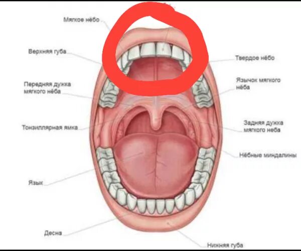 Боли во рту форум. Воспаление твердого неба. Воспалилось твердое небо. Воспаление полости рта на небе.