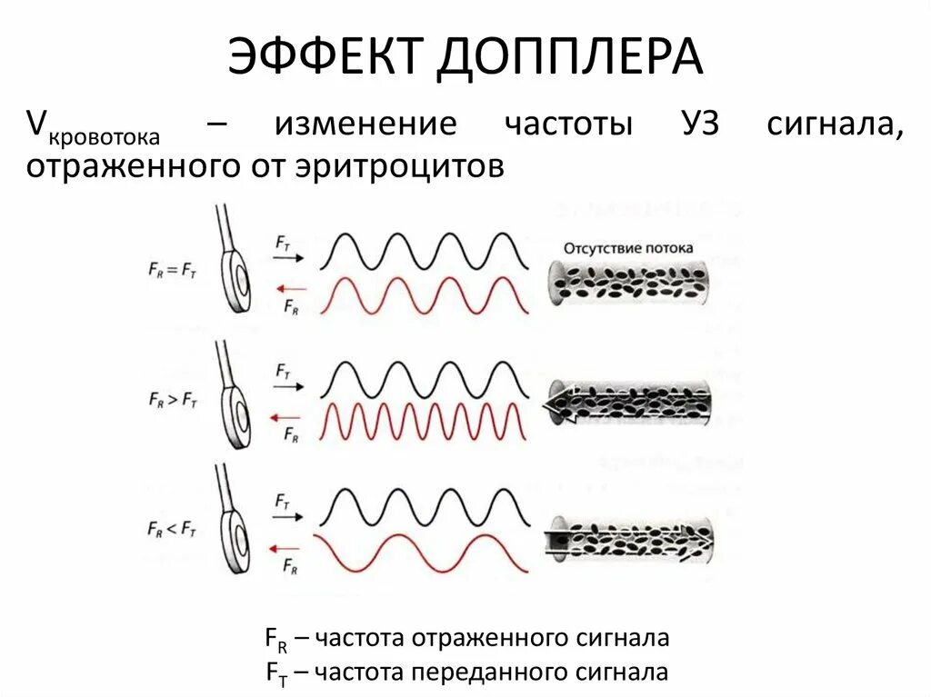 Эффект доплера что определяет. Эффект Доплера схема. Эффект допплера для звуковых волн. Эффект Доплера в радиолокации. Эффект Доплера изменение частоты.