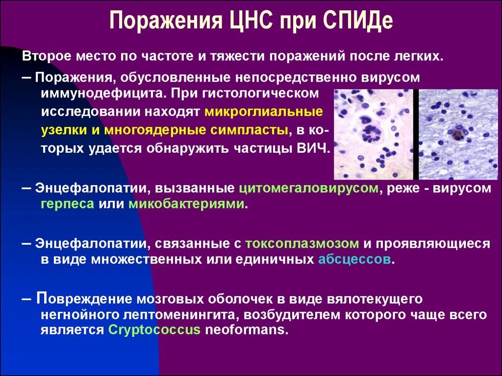 Поражение ЦНС при ВИЧ. Поражение нервной системы при СПИДЕ. Поражение нервной системы при ВИЧ. Патогенез поражения нервной системы при ВИЧ инфекции.