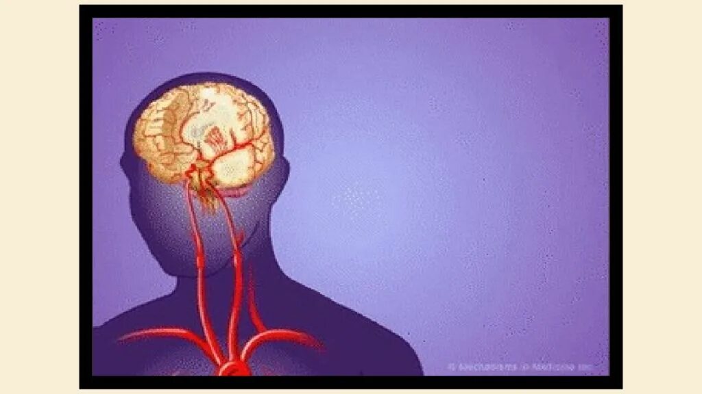 Анимированный мозг. Головной мозг анимация. Ишемический инсульт гиф. Ишемия нерва