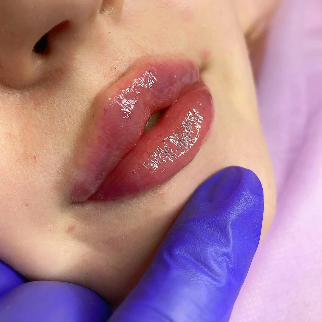 косметолог губы спб